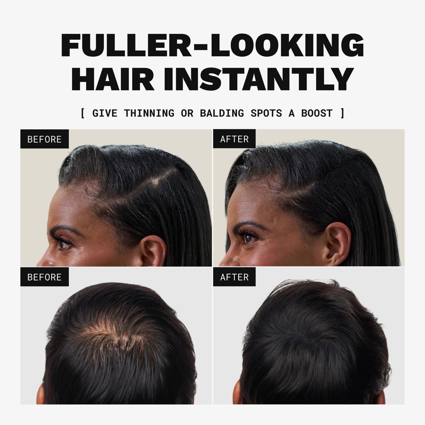Toppik Hair Building Fibers, Dark Brown, 27.5g Fill In Fine or Thinning Hair, Instantly Thicker, Fuller Looking, 9 Shades for Men & Women, Keratin Protein Formula