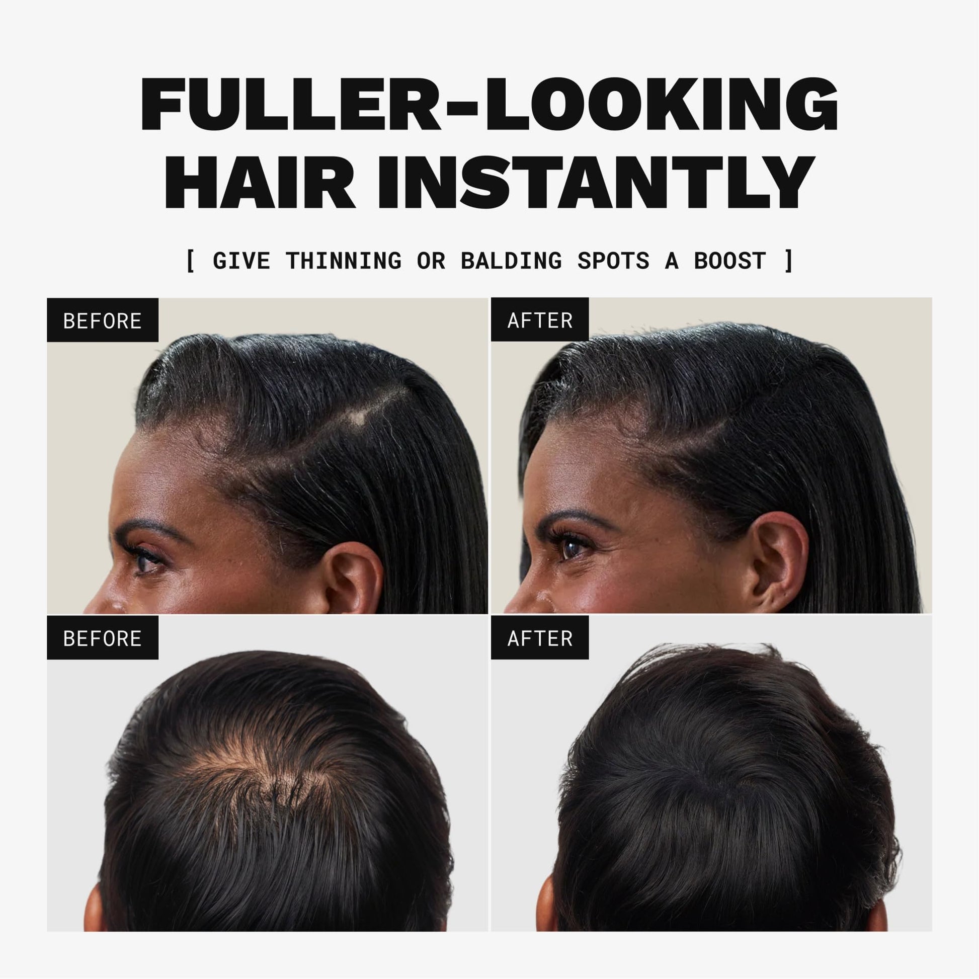 Toppik Hair Building Fibers, Dark Brown, 27.5g Fill In Fine or Thinning Hair, Instantly Thicker, Fuller Looking, 9 Shades for Men & Women, Keratin Protein Formula
